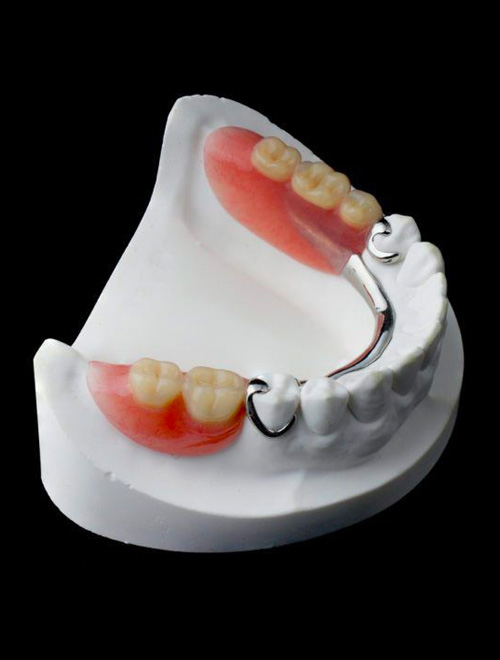 img-service-dentures-01